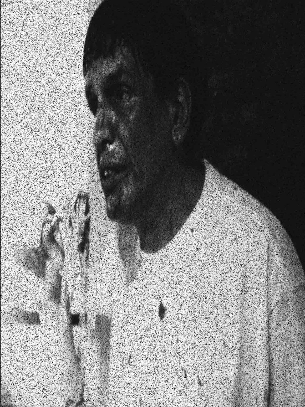 Oh Dear Lord What is Wrong With Your Face?