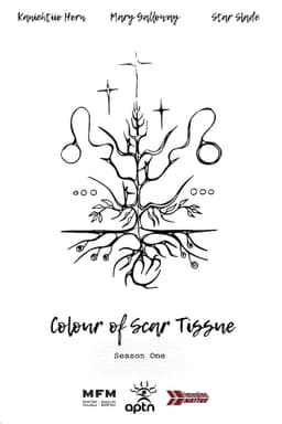 Colour of Scar Tissue