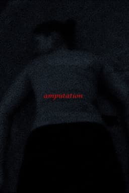 Amputation