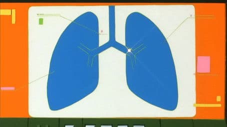 Decisive Micro-Battle!