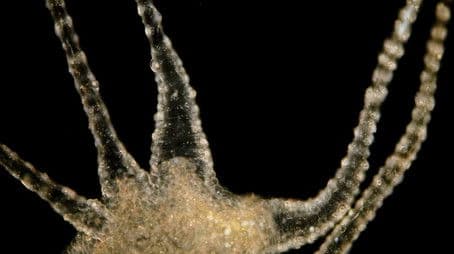 The Beautiful, Brutal Tentacles of Hydra