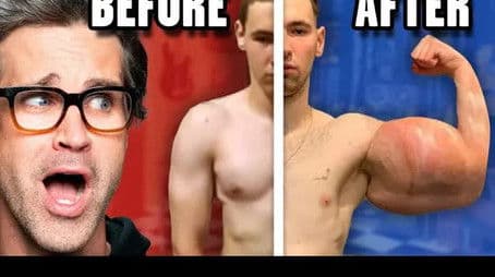 Reacting To Extreme Before And After Photos