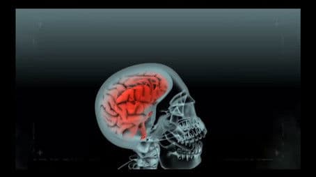 Stupid Is as Death Does