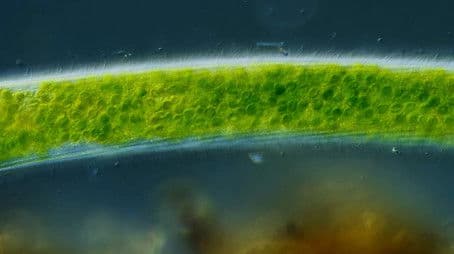 We Found a Super Rare Microbe!