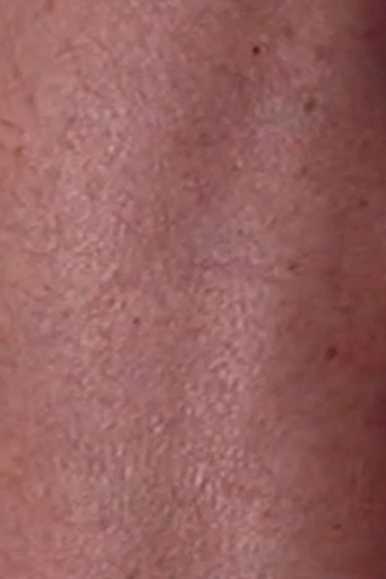 Suite: My Father's Leg