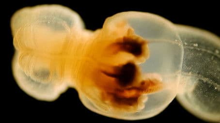 Where Is This Anemone Really From?