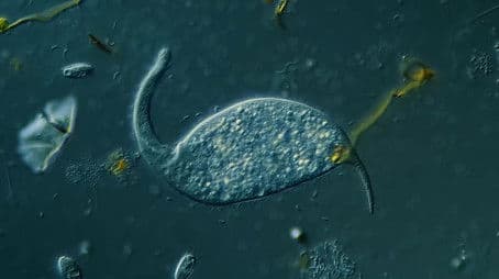 Dileptus: The Toxic Micro Elephant With an Insatiable Appetite