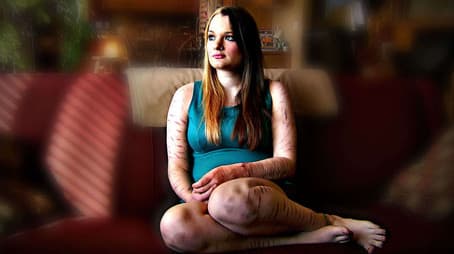 "I Shared My Darkest Secret on Social Media and Now There is a Petition to Kick Me Offline"